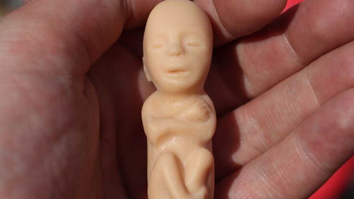 Immagine di Chi ha ancora paura dell’aborto