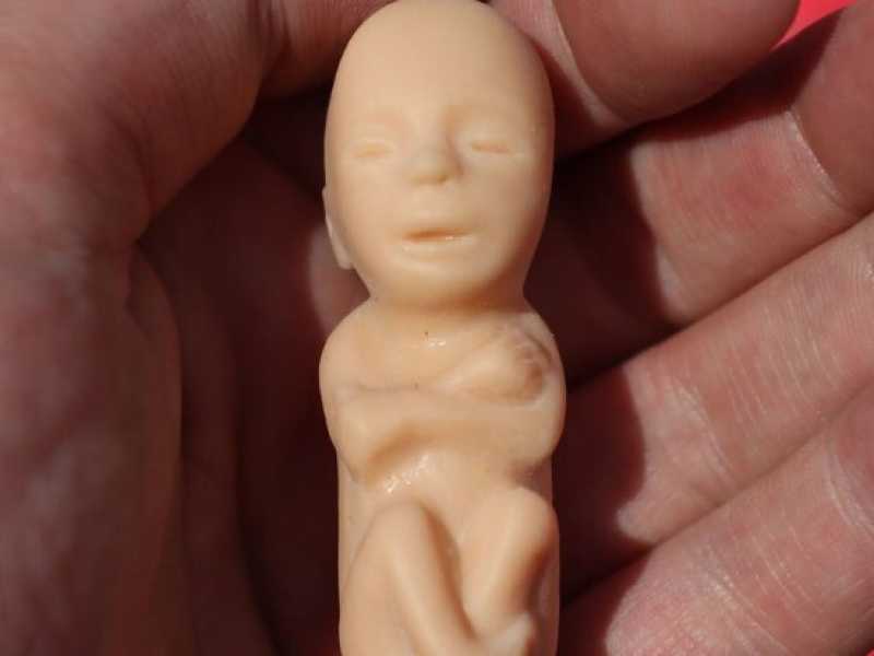 Un feto di plastica mostrato durante una manifestazione pro-life in Irlanda (foto LaPresse)