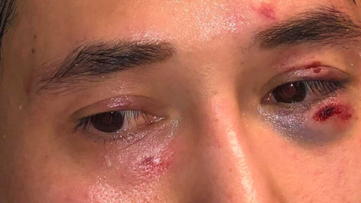 Immagine di Violenza antifa