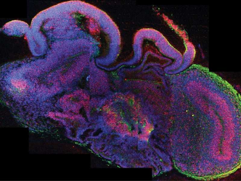 Cervello umano in miniatura sviluppato in laboratorio (EPA/IMBA/MADELINE A. LANCASTER)