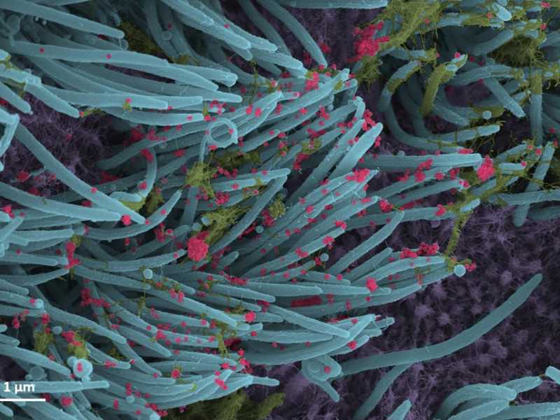 Struttura e densit&agrave; delle particelle del virus SarsCoV2 (in rosso) nelle cellule umane (in blu) che rivestono i bronchi, 14 settembre 2020. ANSA / Ehre Lab, UNC School of Medicine
