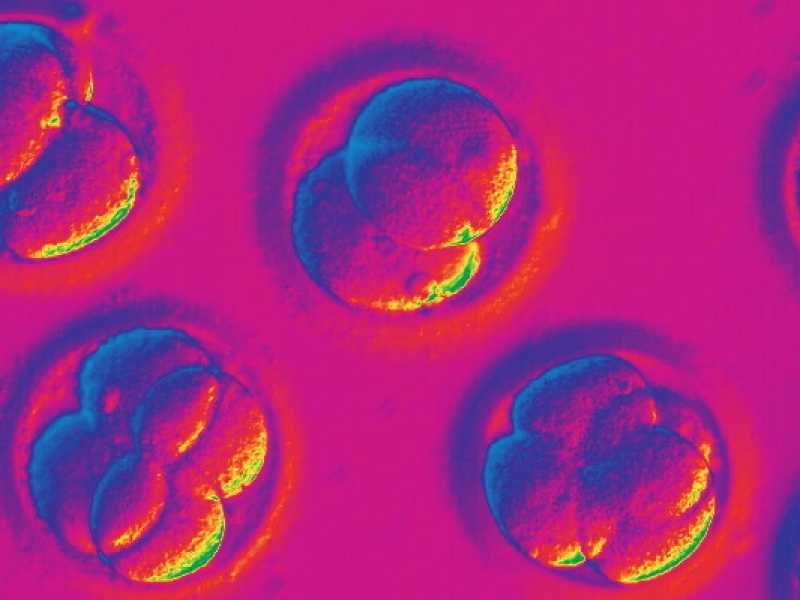 Embrioni umani visti al microscopio (via AP)