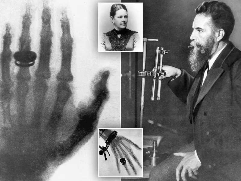  Lo scienziato Wilhelm Röntgen, inventore dei raggi X, e la moglie Anna - foto Facebook Stefano Fortini